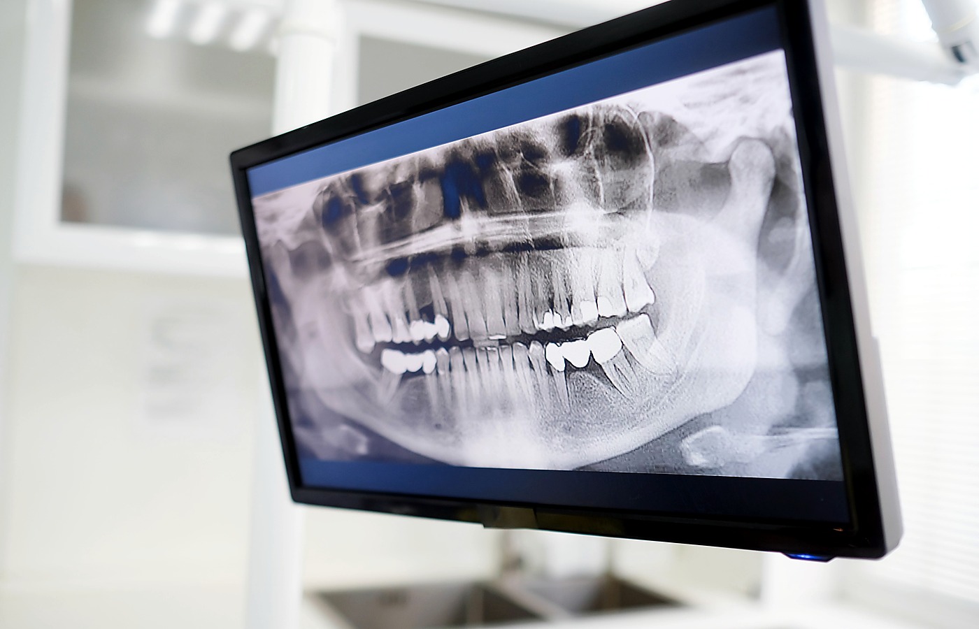 Pantalla de tecnología dental para planificación y revisión
