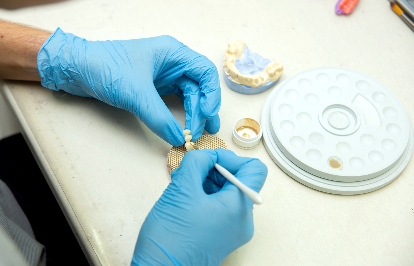 Elaboración de restauraciones dentales en laboratorio